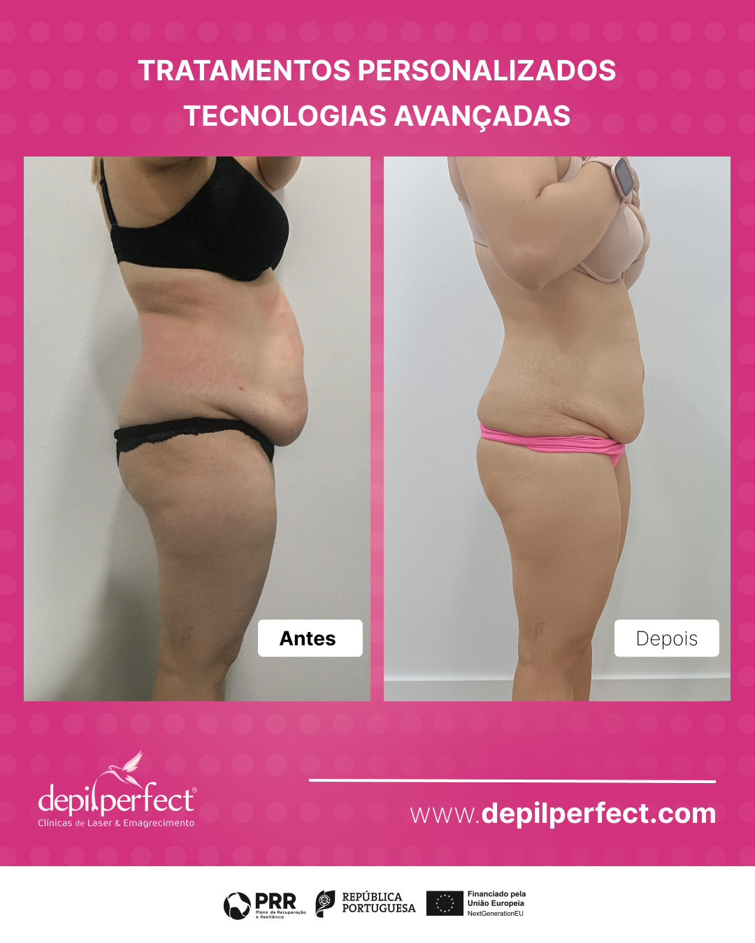 Antes e Depois 1 antes